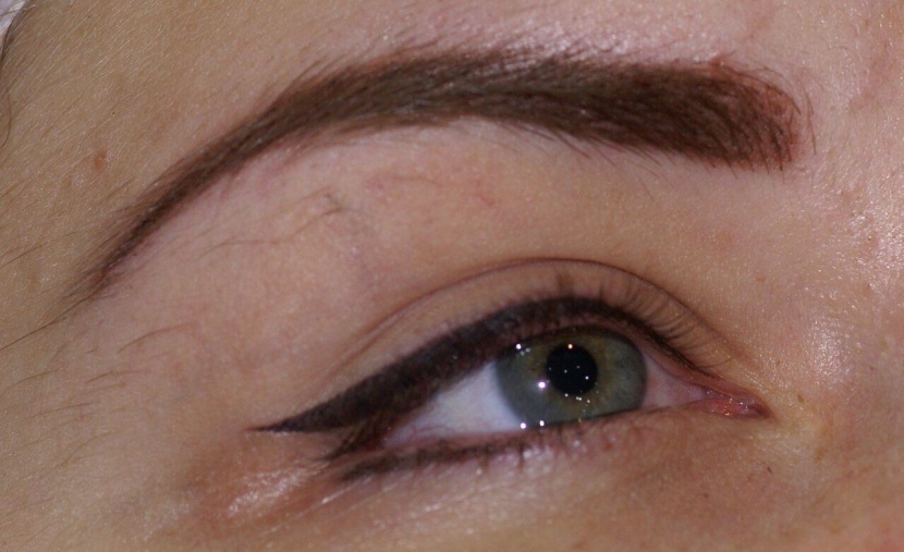 В Алдане в результате косметологической процедуры женщина ослепла на один глаз